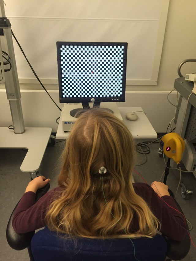 Multifokal VEP undersøgelse