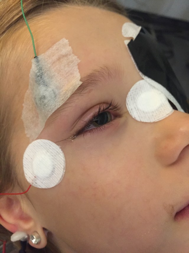 Man kan lige ane trådeni øjet der går mellem de 2 plaste