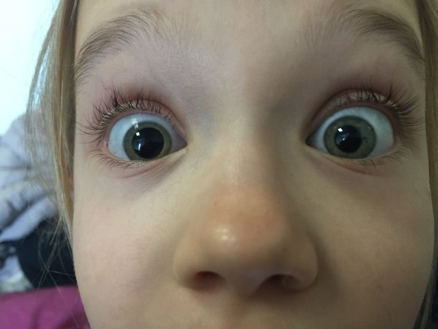 Venstre øje er ved at være der, mht. pupillens udvidelse :)